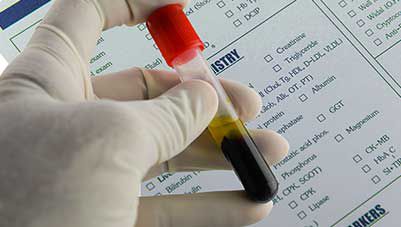 path-lab-centres-in-tier-ii-and-iii-a-growing-market-for-doctors-to-leverage 2